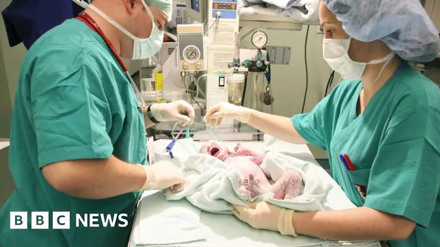 One in four births in England are emergency caesareans