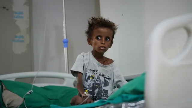 Yemen's hospitals overwhelmed by wounded as civil war returns