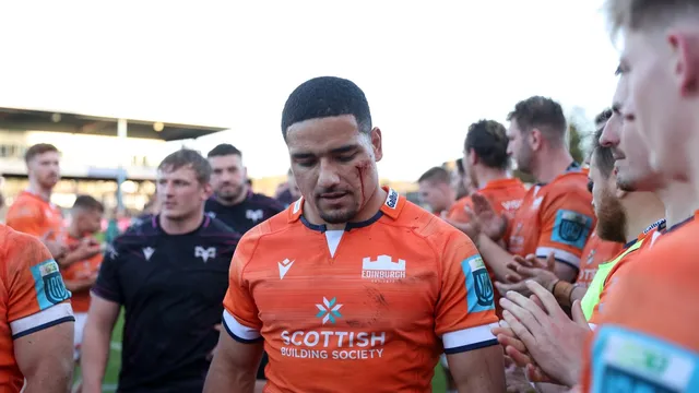 Edinburgh faces disaster after losing seven key players for Gloucester clash