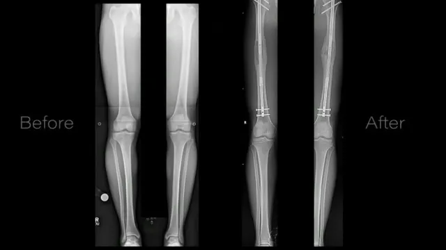 Tom Brada advocates for the advantages of being short