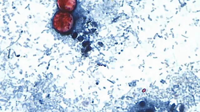 Two deaths confirmed in Michigan cyclospora outbreak