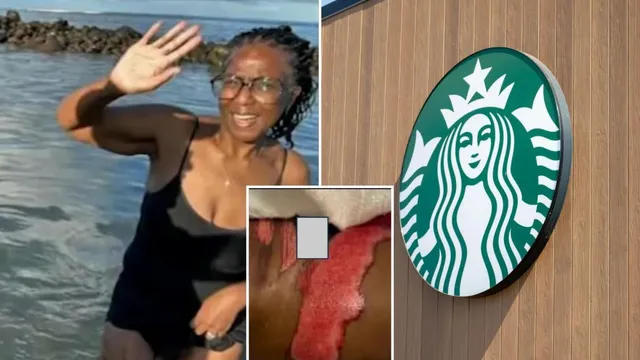 Woman sues Starbucks after suffering severe burns from coffee spill