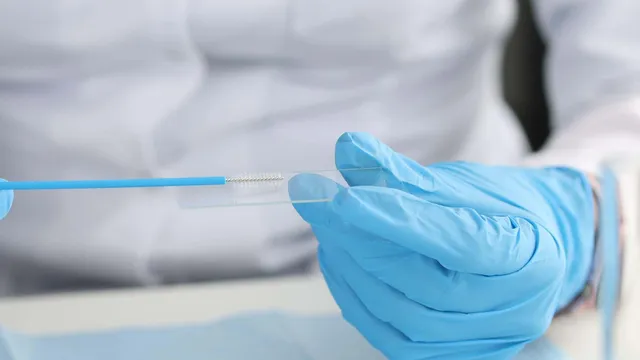 NHS offers self-sampling cervical screening kits to boost participation
