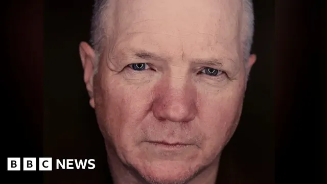 Thousands in Northern Ireland at risk of hereditary health condition