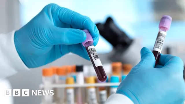 England leads the world in hepatitis C elimination efforts