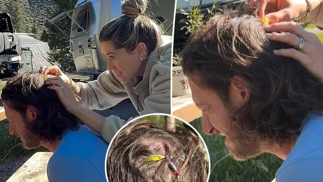 Tyler Hubbard suffers fishing accident while camping with family