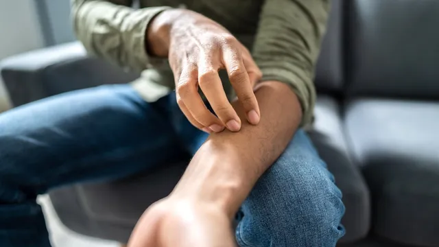 Minnesota reports outbreak of contagious fungal infection spreading through sexual contact