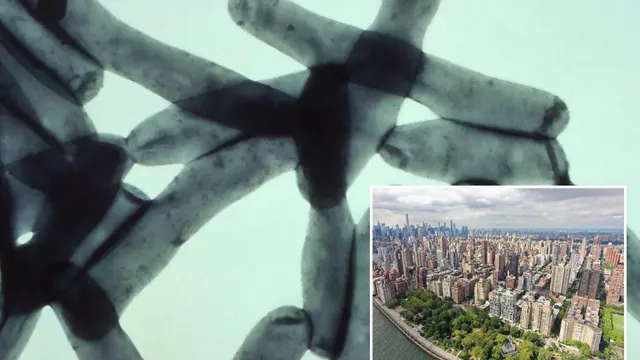 Seventh death reported in NYC Legionnaires' disease outbreak
