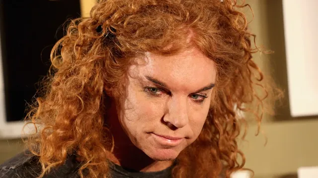 Comedian Carrot Top hospitalized in Las Vegas after apparent suicide attempt