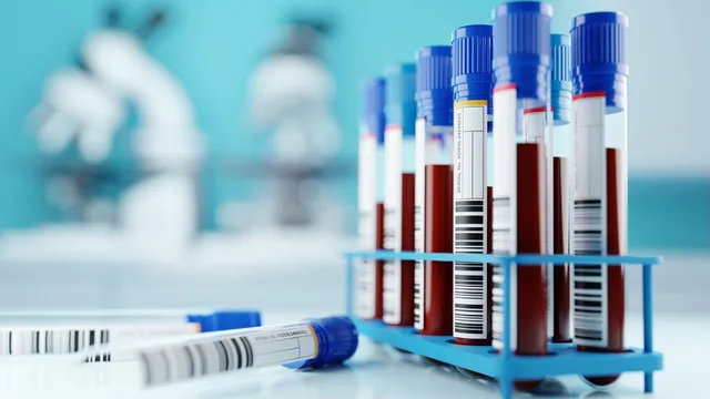 Blood tests show limited ability to predict Alzheimer's risk early