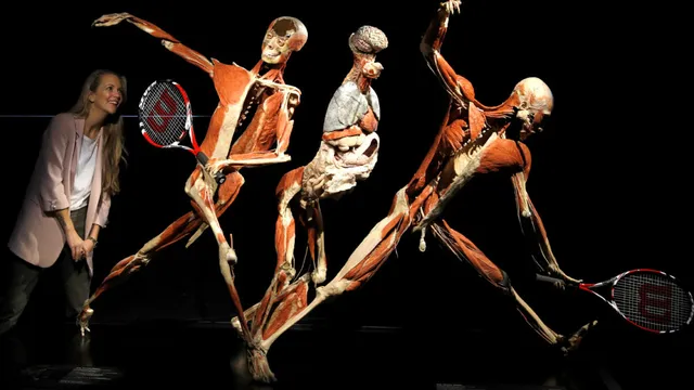 Gunther von Hagens dies, leaving a controversial legacy in anatomy