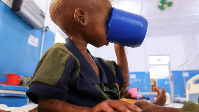 Somalia faces severe hunger crisis as aid funding plummets