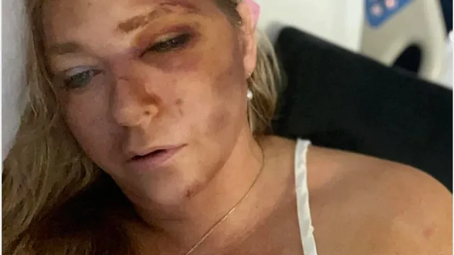 Virginia Giuffre claims imminent death following serious car accident