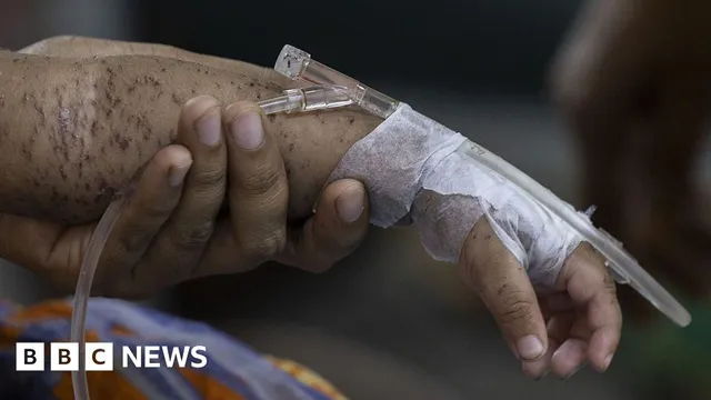 Hundreds of children die from measles outbreak in Bangladesh