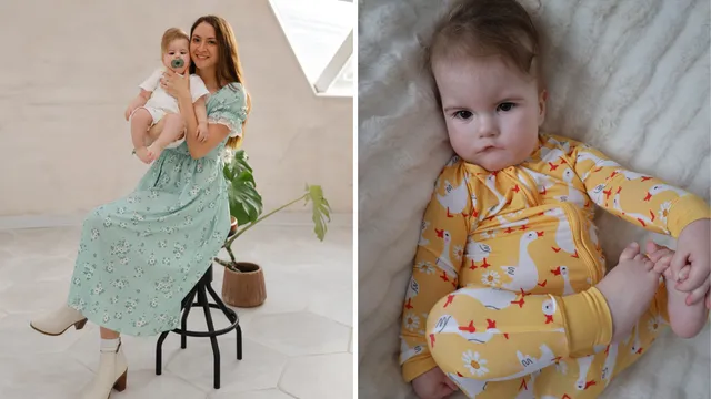 Mother learns her baby will never smile due to rare syndrome