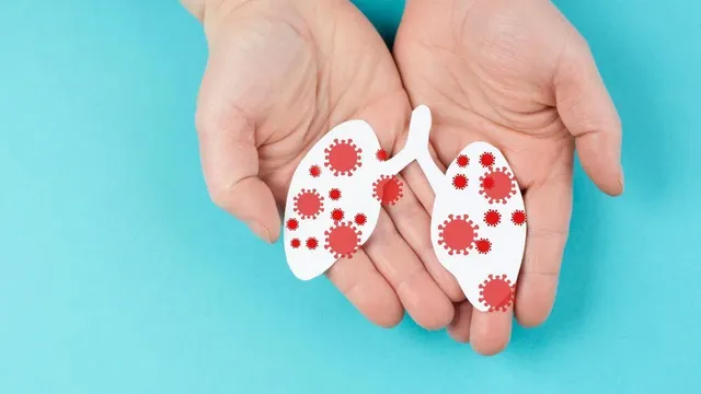 Health minister reveals 85% of TB cases in Malaysia involve locals