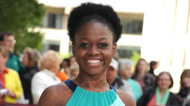 Michaela DePrince, trailblazing ballerina, dies suddenly at 29
