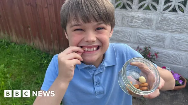 Cardiff boy with 20 allergies travels to the US for life-saving treatment