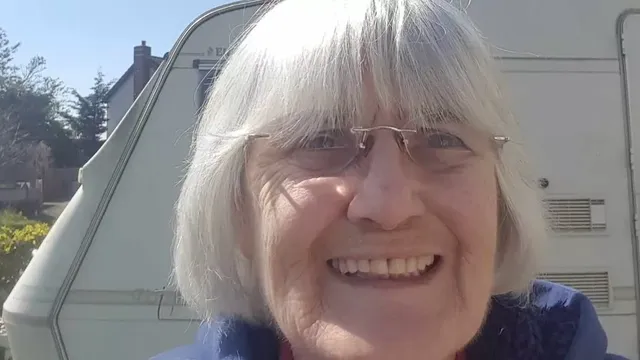 Elderly woman extracts own teeth after years of waiting for dental care