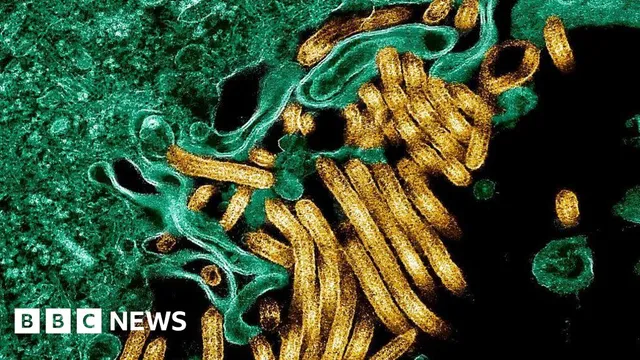Ebola outbreak claims 65 lives in eastern DR Congo