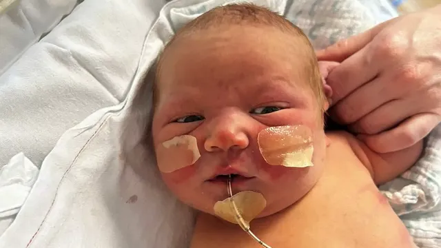 Newborn suffers life-threatening bleeding due to stomach ulcers