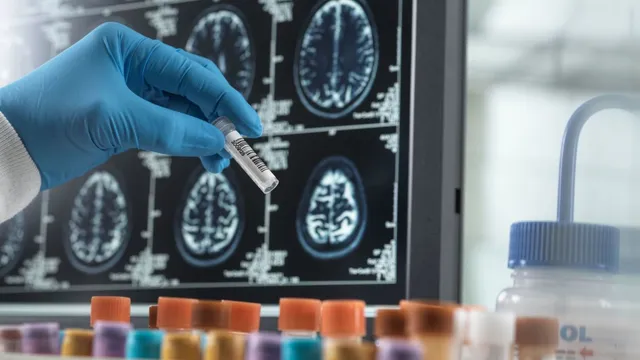 Tackling Dementia: Urgent Action Needed for Early Diagnosis in the UK