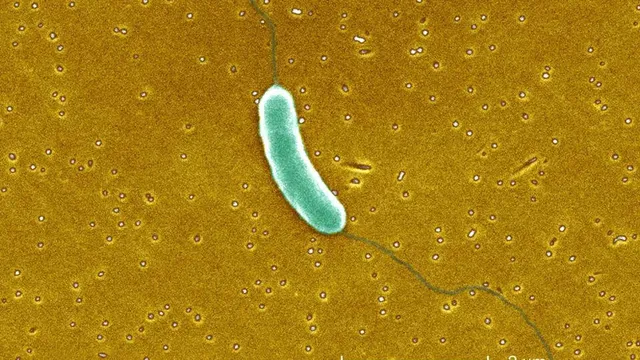 Five Louisiana residents die from flesh-eating bacteria infections