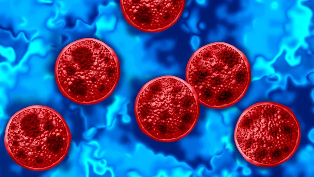 Two deaths reported in Michigan Cyclospora outbreak