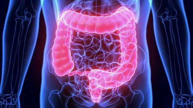 New research debunks gut microbiome link to autism