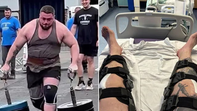 Strongman Dan Jones Injured in Southport Competition