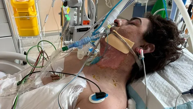 Robot vacuum explosion leaves tradie fighting for life