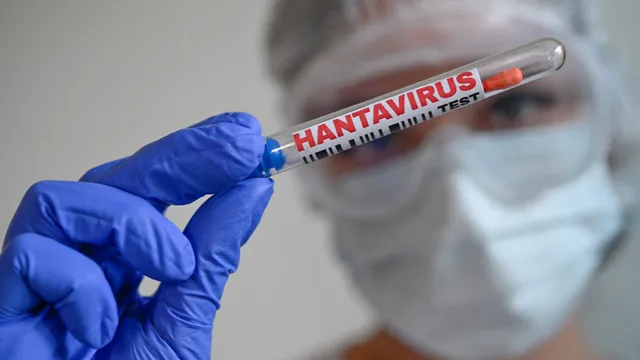 New York student recovers from suspected hantavirus infection