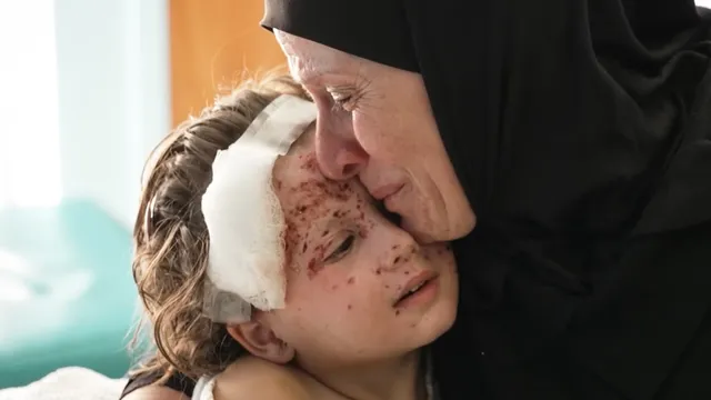 Surgeon sheds light on devastating injuries of Lebanese children from Israeli attacks