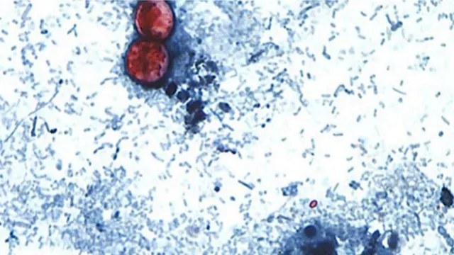Michigan sees nearly 1,000 cyclosporiasis cases linked to contaminated produce