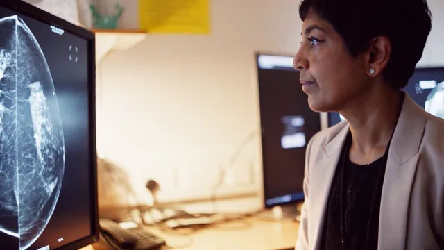 AI improves breast cancer detection rates significantly