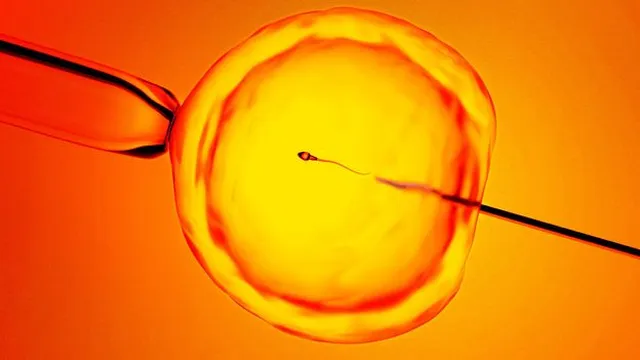 AI gives hope to men diagnosed with infertility by finding sperm