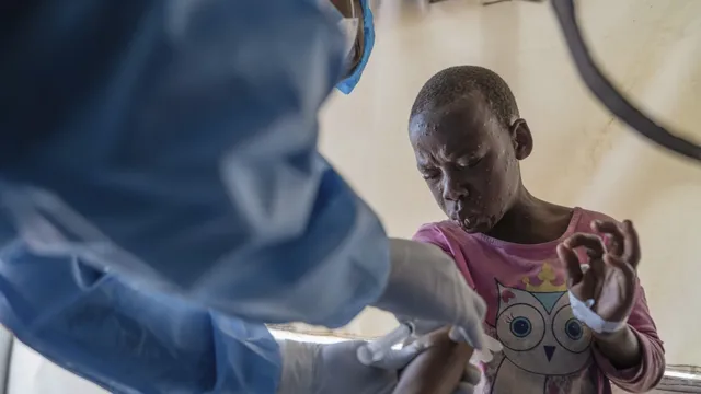 Mpox deaths surge in Africa, CDC calls toll unacceptable