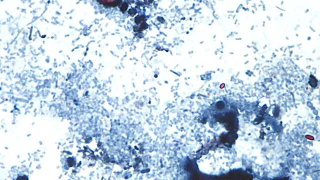 FDA retracts positive test linking cyclospora to Taylor Farms lettuce