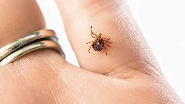 Pilot dies after rare meat allergy linked to tick bite