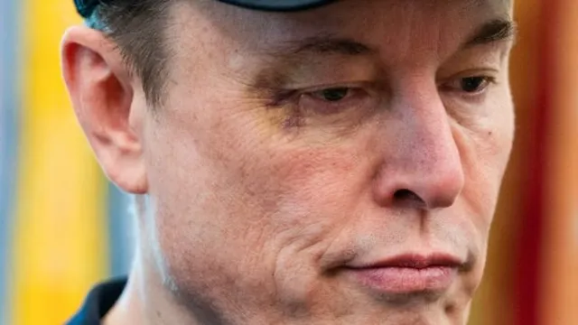Elon Musk reveals black eye came from son's playful punch