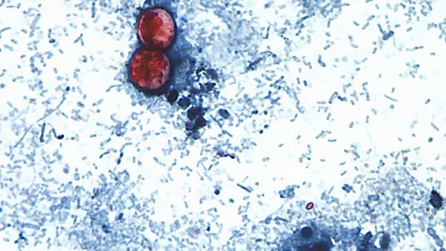 Taco Bell customer hospitalized after severe cyclospora outbreak