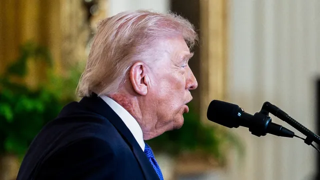 Trump's neck rash raises health concerns amid White House assurances