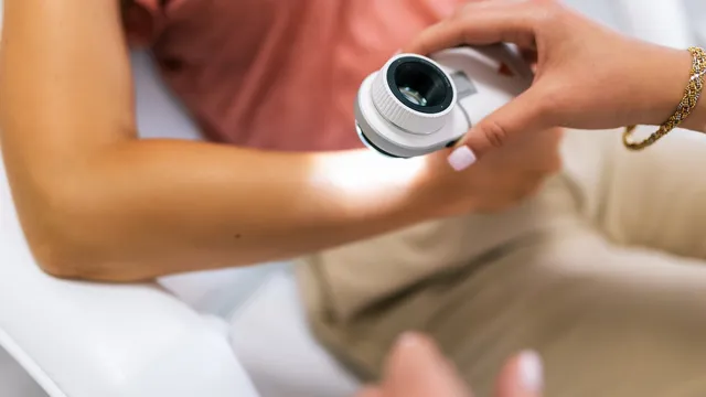 Skin cancer cases expected to soar by 50% by 2040
