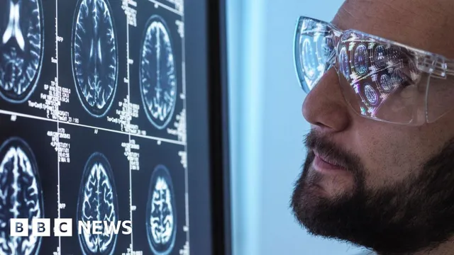 Novo Nordisk faces major setback after Alzheimer's trial failure