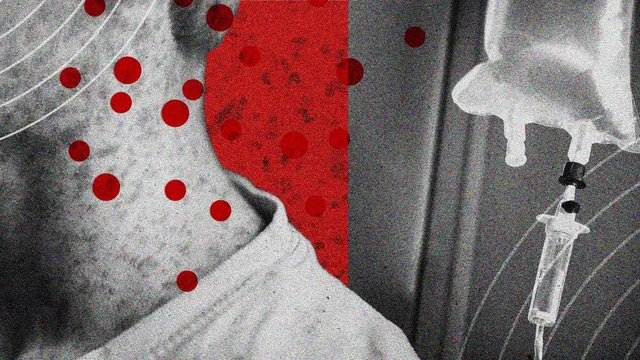 Measles cases surge as vaccination rates plummet in the US