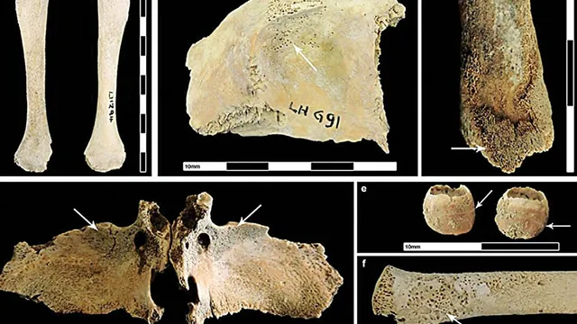 Roman occupation severely affected health of British population