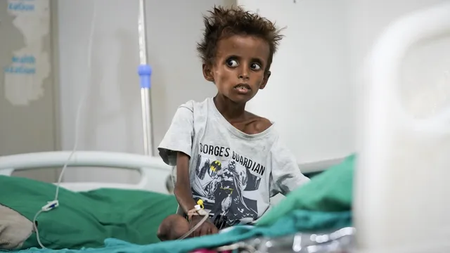 Yemen's hospitals face crisis as civil war escalates and resources dwindle