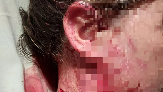 Child Injured in Dog Attack; Owner Arrested Under New UK Laws