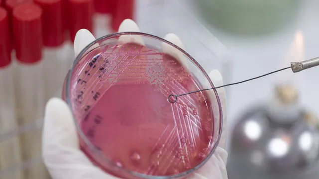 Experts warn antimicrobial resistance could become deadlier than cancer by 2050