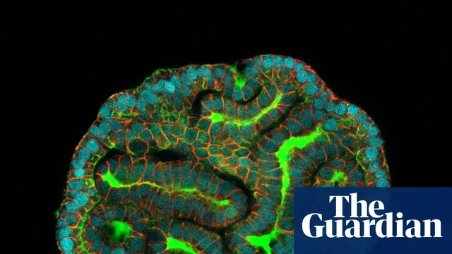 Scientists grow miniature human organs to improve drug testing
